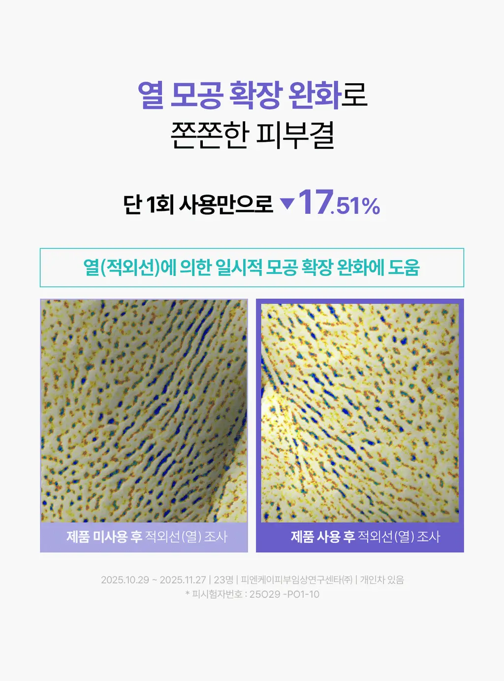 [5월 올영픽/9중 모공지표 개선/올리브영 단독 런칭] 리쥬란 더마 힐러 포어 타이트닝 겔 마스크 5매 상세페이지 19